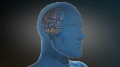 γ頻率神經調節治療阿爾茨海默病6個月延緩認知功能達83% γ頻率神經調節治療阿爾茨海默病6個月延緩認知功能達83%