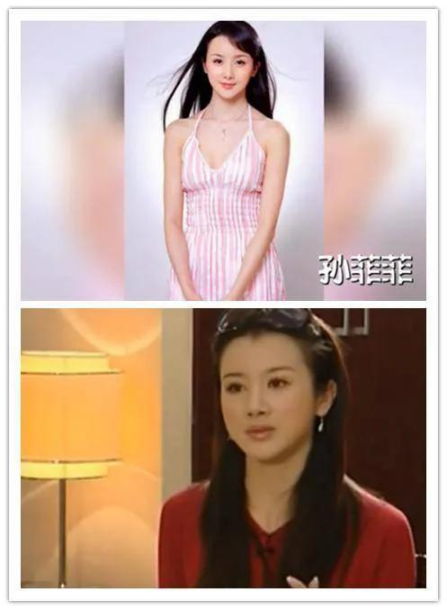 整容失敗的幾位明星