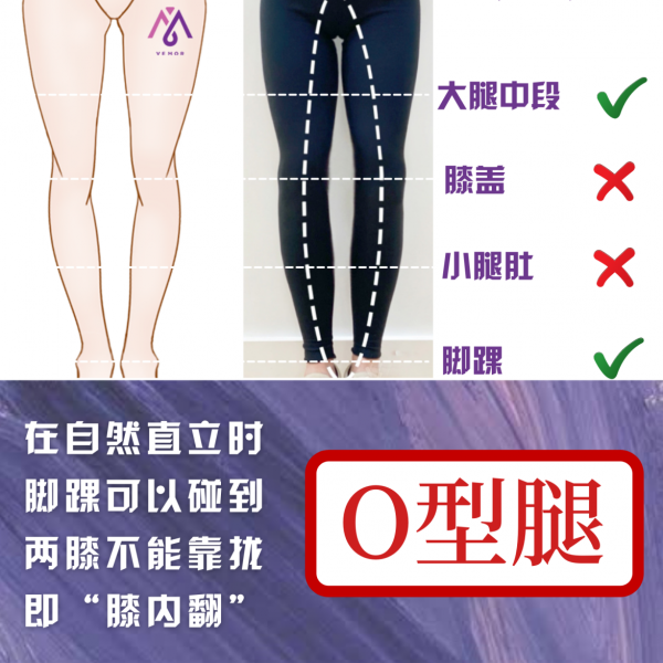 VEMOR變美乾貨｜你瞭解你的腿形嗎？