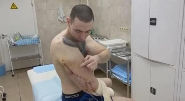 “俄羅斯大力水手”，61釐米手臂面臨手術，否則將有截肢風險