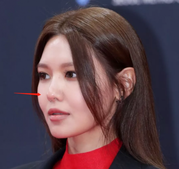 好多整容臉！外網曝韓國頒獎禮生圖，明星動鼻子後遺症太明顯