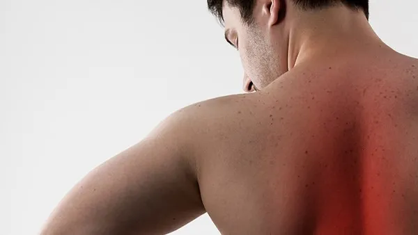 神經性皮炎的症狀都有哪些，與毛囊炎有關係嗎？