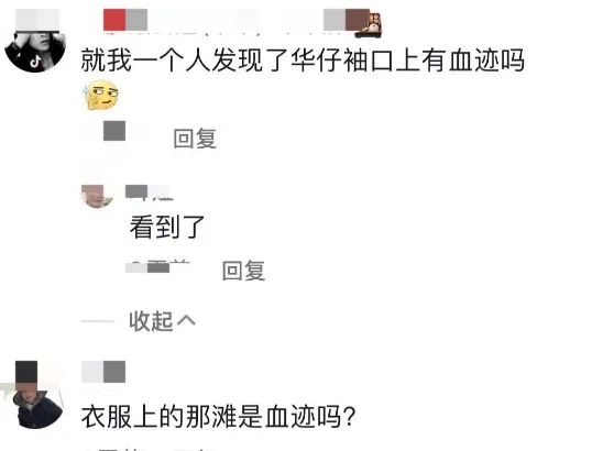 61歲劉德華拍影片秀廚藝,右手臂現出紅色血跡,身體狀況令人擔心 61歲劉德華拍影片秀廚藝,右手臂現出紅色血跡,身體狀況令人擔心