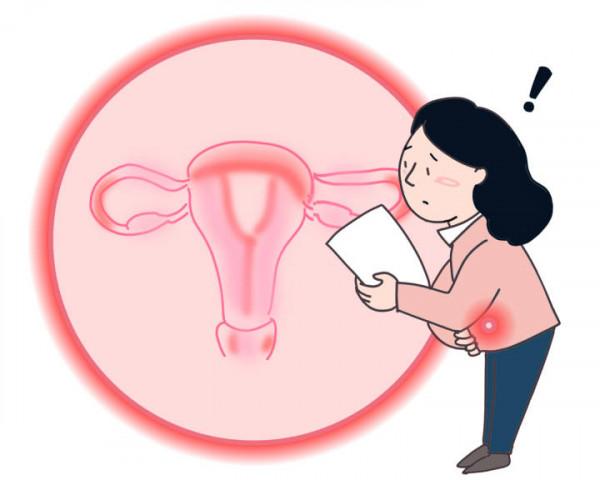 每個女性都要了解的“恐怖”癌症:發現時常常已是晚期,複發率高,生存率低…… 每個女性都要了解的“恐怖”癌症:發現時常常已是晚期,複發率高,生存率低……