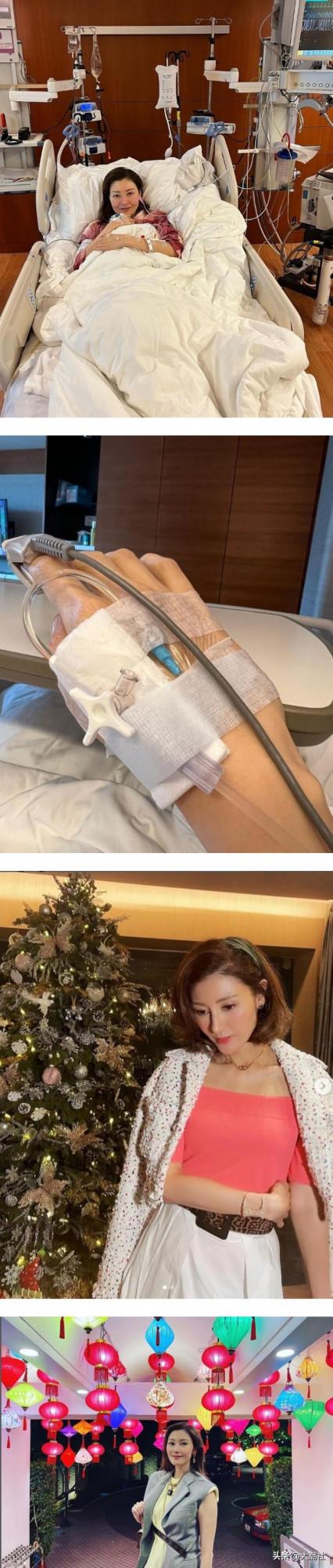 香港藝人李嘉欣插鼻管+雙手插滿管：撿回條命，躺ICU搏鬥48小時