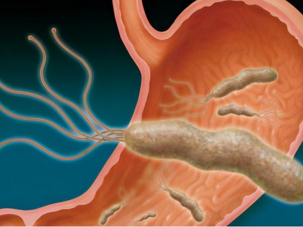 3要給胃貼上“保護膜”，增強黏膜屏障，抗炎抗氧化，防治胃潰瘍
