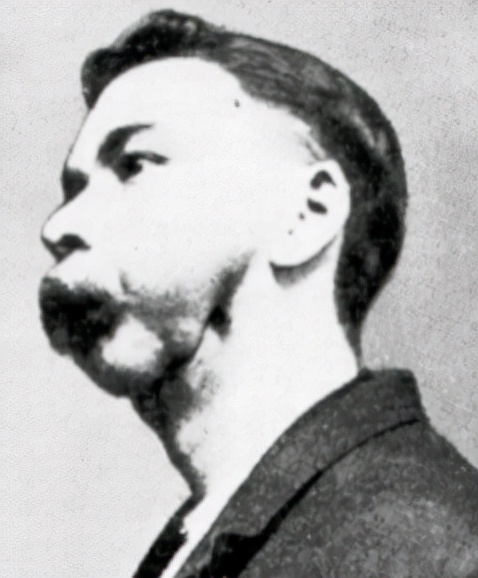 牙齒爛光,臉長巨瘤,骨頭還會發光,被美國資本家逼向絕路的女工 牙齒爛光,臉長巨瘤,骨頭還會發光,被美國資本家逼向絕路的女工