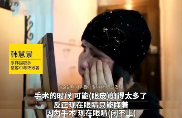 “整容上癮”韓慧景：把臉整成電風扇，自行注射食用油，代價慘痛