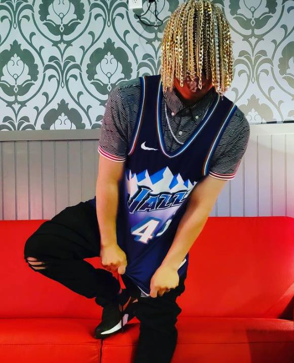 墨西哥Rapper頭皮植入數十條大金鍊，搞了一頭名副其實的金髮