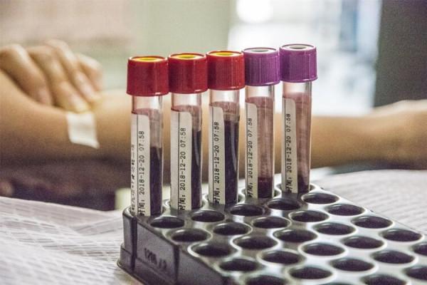 肝癌很會“偽裝”,提醒:面板出現3種異常,可能是肝在“呼救” 肝癌很會“偽裝”,提醒:面板出現3種異常,可能是肝在“呼救”