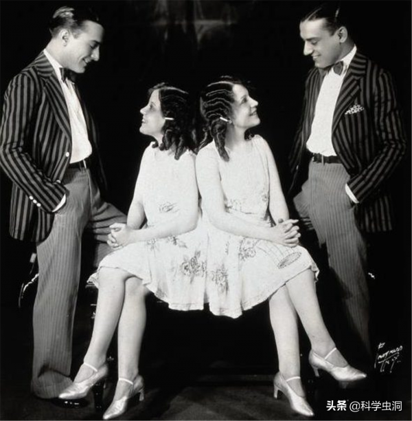 連體人一個去世怎麼辦？連體姐姐死後，妹妹被迫和遺骸生存2天