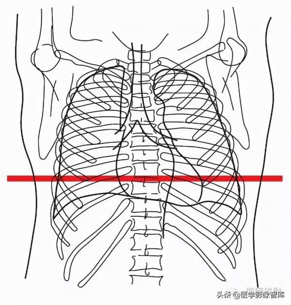 CT斷層解剖圖譜最全總結「推薦收藏」 CT斷層解剖圖譜最全總結「推薦收藏」