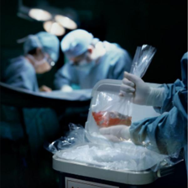 1984年,美國一女嬰移植狒狒心臟手術成功,女孩最後能不能活下去 1984年,美國一女嬰移植狒狒心臟手術成功,女孩最後能不能活下去