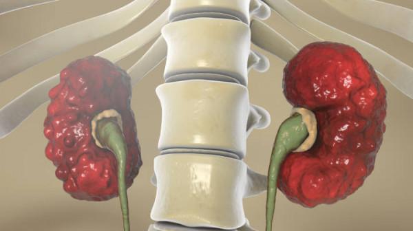 3歲“小葡萄”常哭鬧卻不長個，竟是從孃胎裡帶出來的毛病