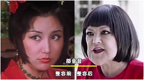 被整容毀了的7位明星，雖各有各的苦衷，卻都美麗盡失、事業滑坡