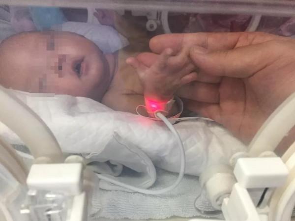 新生兒 早產兒 極低體重兒腦出血的綜合治療與持續康復