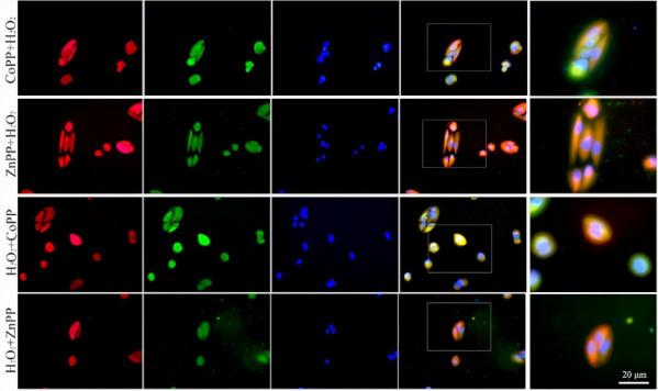 中國之聲丨李朝輝教授:如何系統性做好白內障的基礎研究? 中國之聲丨李朝輝教授:如何系統性做好白內障的基礎研究?