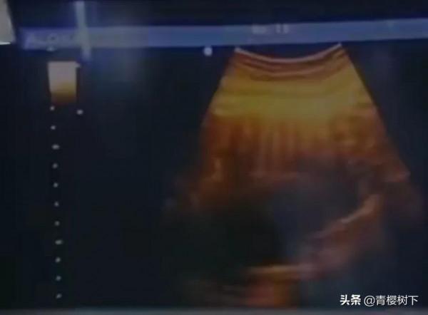 偉大的母愛!植物人孕婦奇蹟產子 偉大的母愛!植物人孕婦奇蹟產子