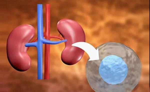 身體有這幾種表現，預示腎臟受損