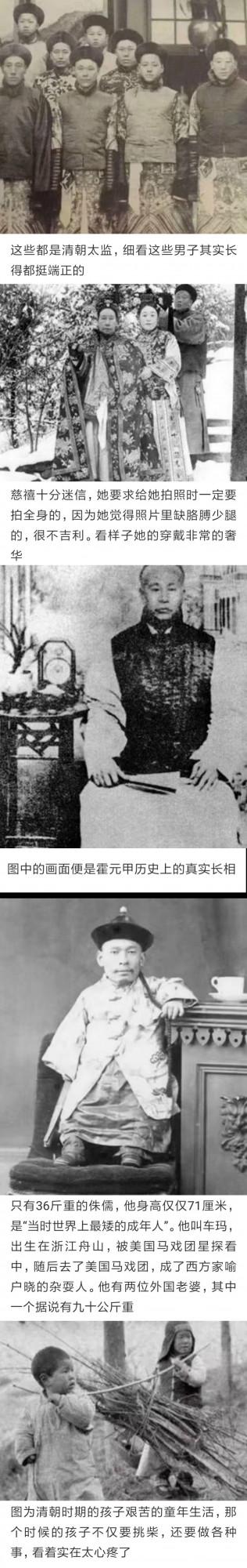 上世紀的老照片，你見過嗎？原來過去的人是這樣拔牙的