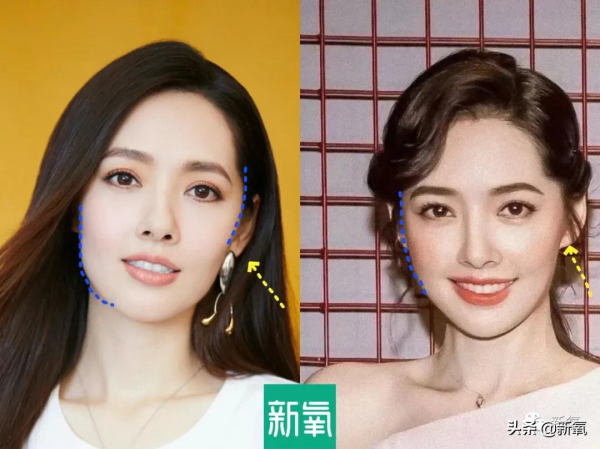 是時候停止高顱頂審美PUA了