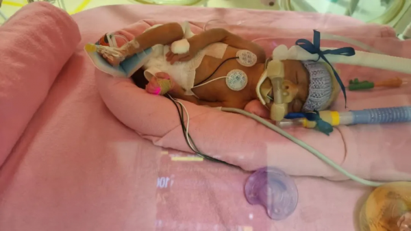 “我的孩子在新加坡早產,只有1kg重!面臨35萬天價賬單......” “我的孩子在新加坡早產,只有1kg重!面臨35萬天價賬單......”