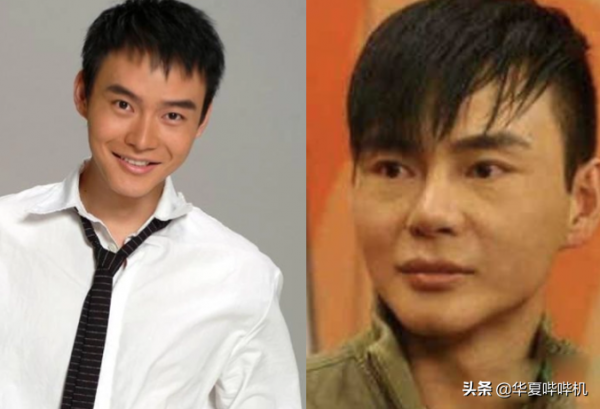 明星大型“翻車”現場，她們是如何整容變毀容的