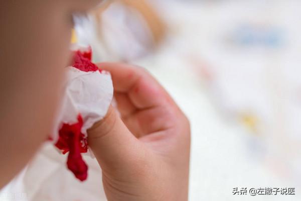 小兒流鼻血花費將近千元,卻查不出病因?是否存在濫開檢查? 小兒流鼻血花費將近千元,卻查不出病因?是否存在濫開檢查?