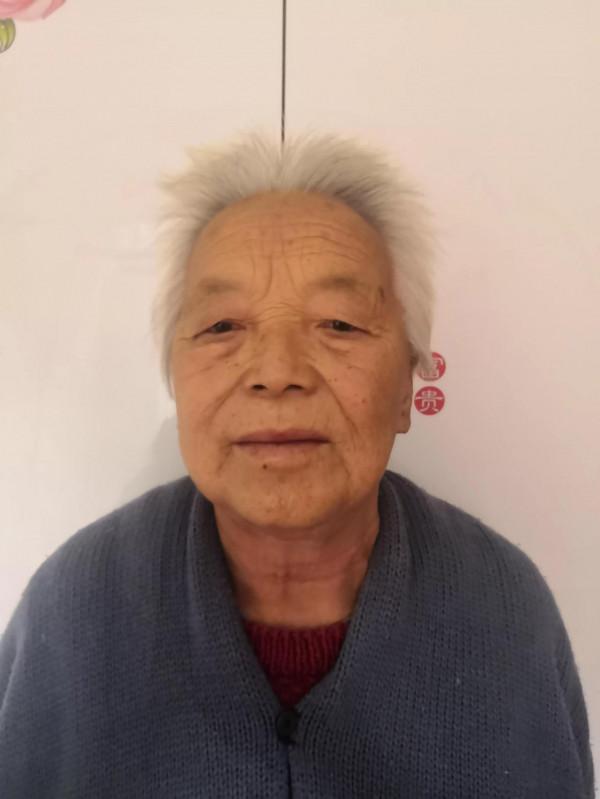 一把木梳,一個吹風機治面癱 一把木梳,一個吹風機治面癱