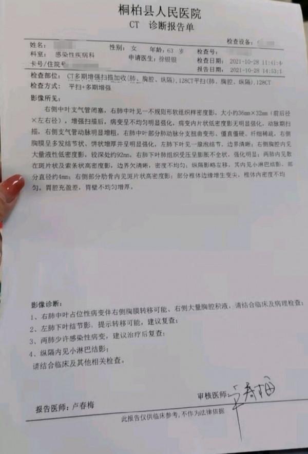 劉懿博士說肺癌（二八六六）咳嗽乏力，63歲女士胸水中找到癌細胞