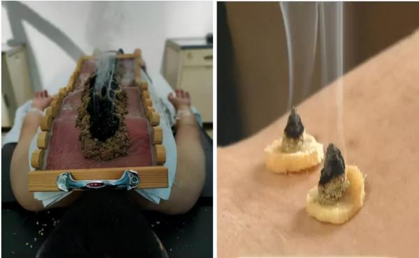 疫情當前，增強免疫是關鍵！灸“透”這些穴，強身又健體