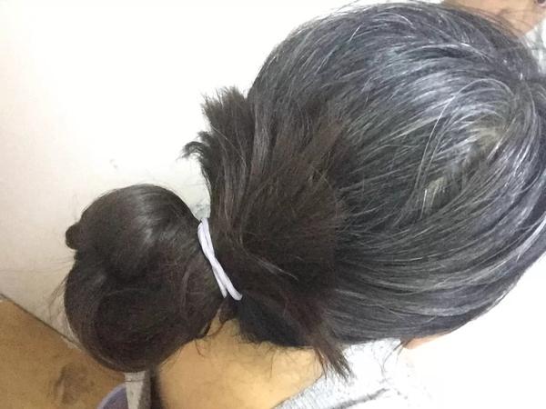 如果女性白頭髮增多,不要總認為老了,或是因為體內缺乏3種營養 如果女性白頭髮增多,不要總認為老了,或是因為體內缺乏3種營養