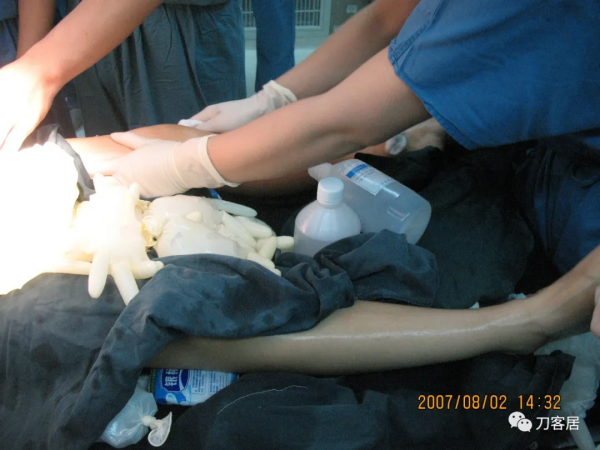 惡性高熱第1例:2007年西京醫院術中“惡性高熱”一例 惡性高熱第1例:2007年西京醫院術中“惡性高熱”一例