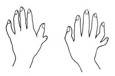 明朝奇案：女子新婚，洞房夜丈夫如廁露端倪，婆婆：那不是我兒子