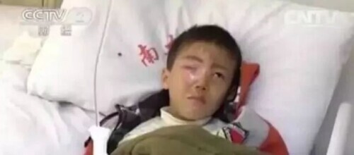 20分鐘孩子眼球被溶化！醫生說這東西每家都有，家長一定要高度警惕