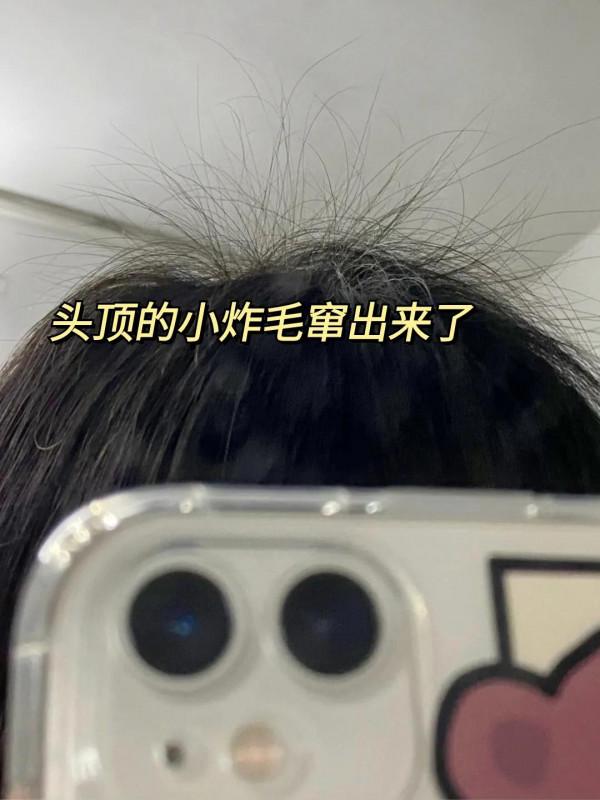 養髮到位，頭髮再也不禿了