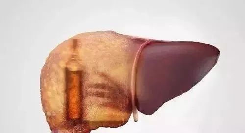 “酒精胃”的4個求救訊號