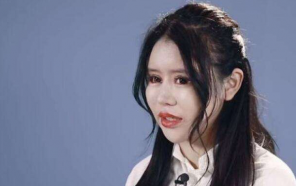 “真人芭比”周楚娜：2年半歷經100多次手術，一張臉抵一輛跑車