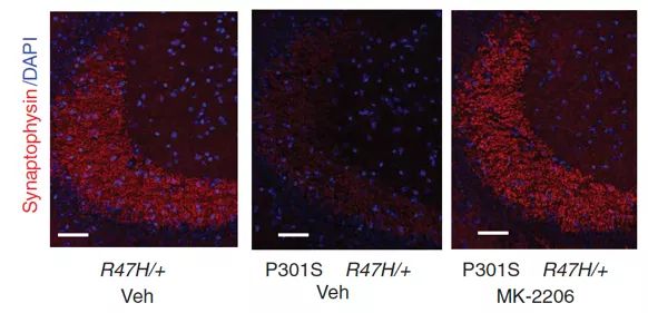 腦科學日報：利用alpha頻率神經調控提高預設網路連線性
