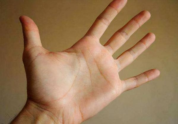 如果肝臟有問題，或許手上有這&OpenCurlyDoubleQuote;4個標誌&rdquo;，不妨瞭解一下