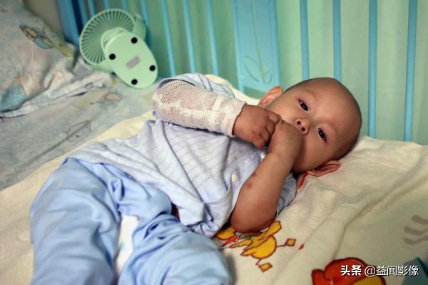 1歲幼童發熱肚脹,醫院檢查結果讓全家人崩潰:腹內腫瘤已拳頭大 1歲幼童發熱肚脹,醫院檢查結果讓全家人崩潰:腹內腫瘤已拳頭大