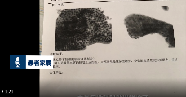 女子月經不調就醫38天后死亡，死亡原因到底是什麼？