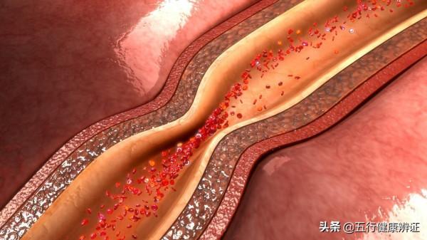 三焦不通，可能血脂高！肝、脾、腎、脈四者同調，降血脂，通三焦