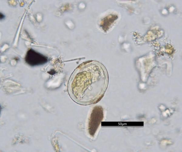 曹操墓新發現祔葬墓，可能是卞後