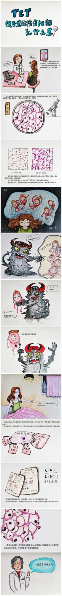 什麼是挖空細胞？有挖空細胞就表示感染了HPV嗎？