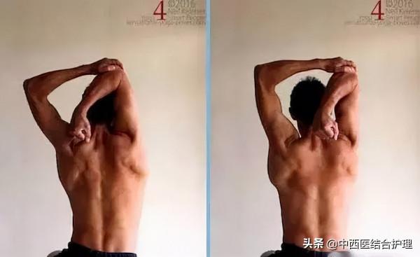 「頸椎養生」肩膀打開了,頸椎竟然再也不痛了 「頸椎養生」肩膀打開了,頸椎竟然再也不痛了