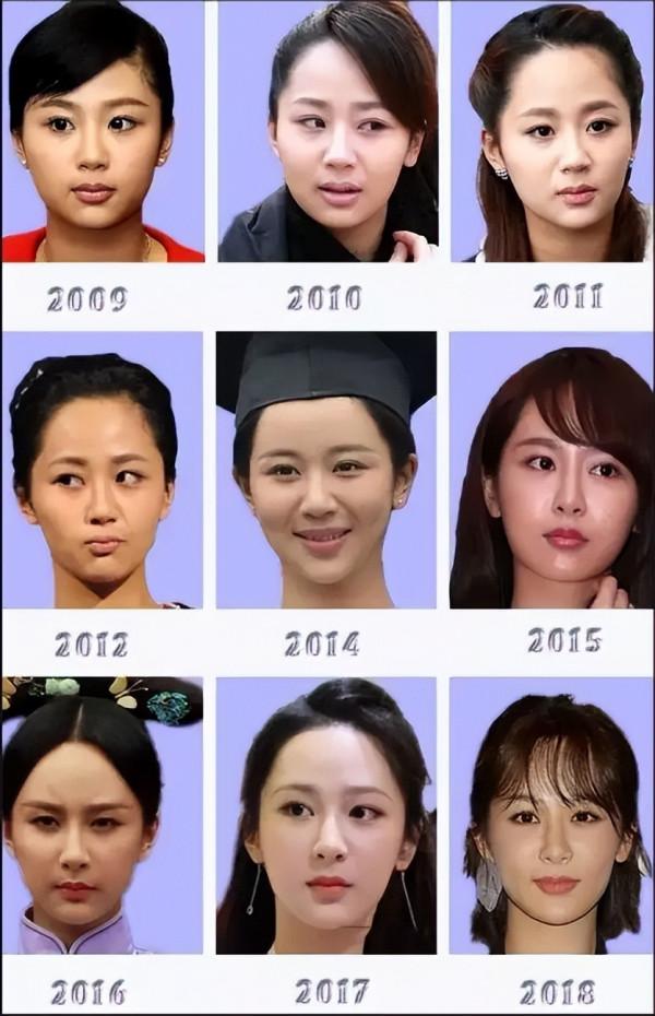 8位“換頭改命”的女明星，楊紫臉蛋已僵硬，鞠婧禕靠換頭出圈