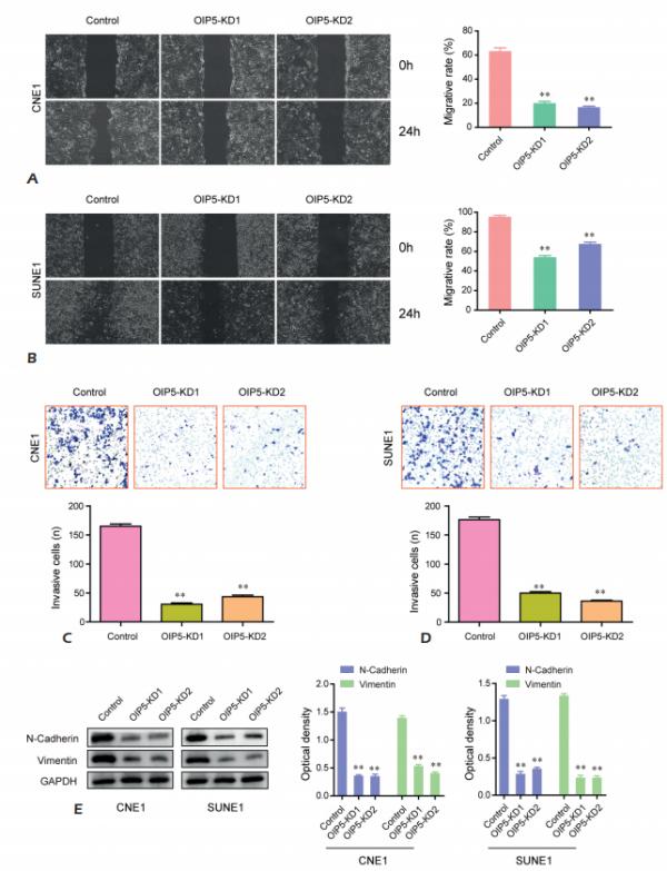 Opa相互作用蛋白5透過調節JAK2/STAT3訊號促進EMT Opa相互作用蛋白5透過調節JAK2/STAT3訊號促進EMT