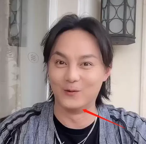 發腮禿頭、酒糟鼻、大肚腩，還有塑膠僵臉，中年男星的辣眼震撼