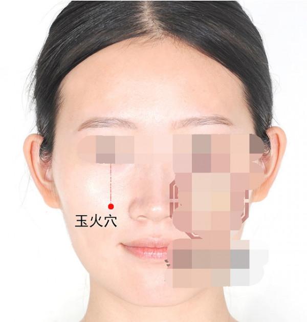 中醫針灸肩部疾病處方1 中醫針灸肩部疾病處方1